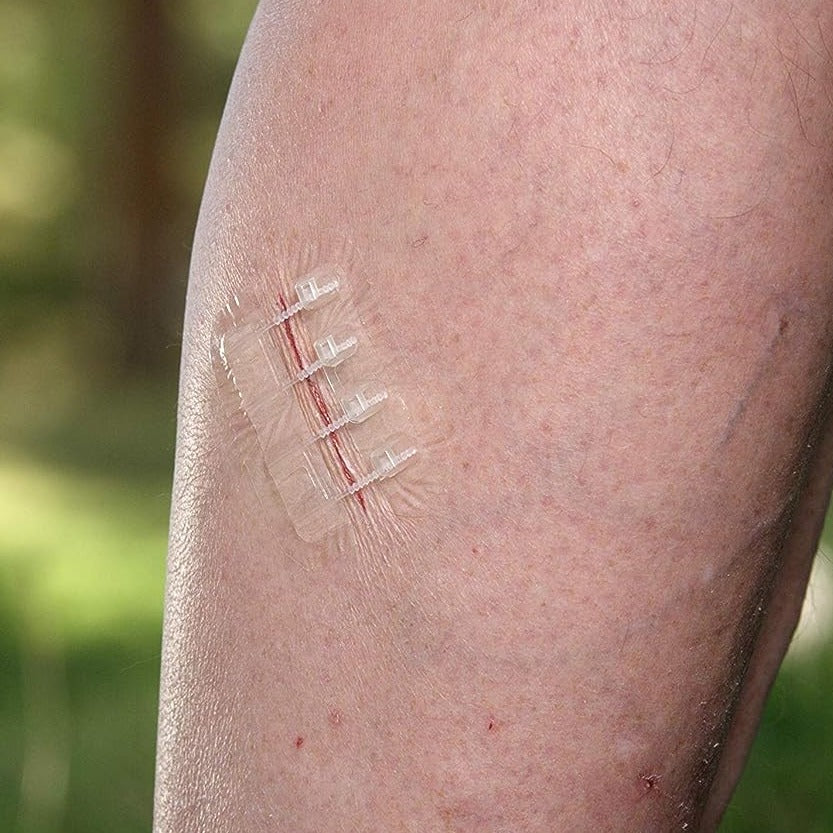 3-Pack Wound Closure Device (PU 2 Straps)