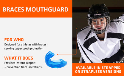 Teeth Alignment Trainer – Reusable Orthodontic Mouth Guard