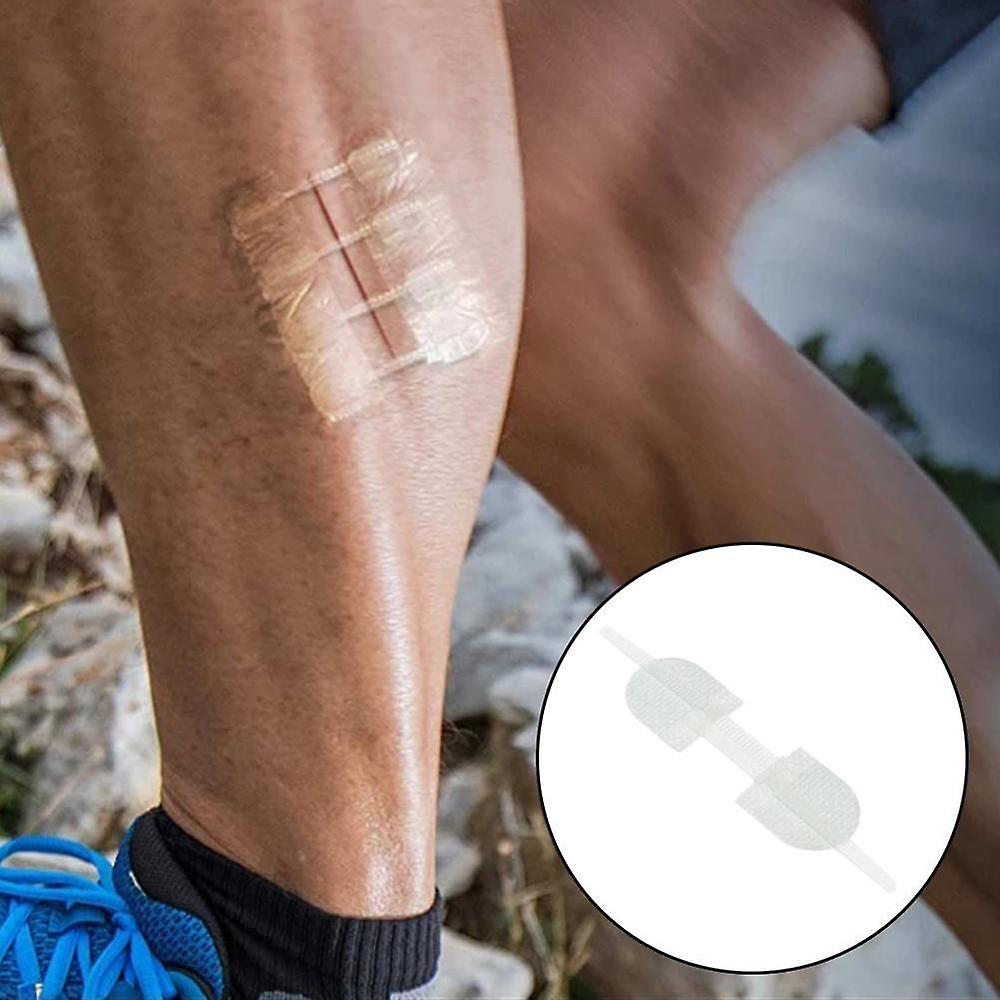 3-Pack Wound Closure Device (PU 2 Straps)