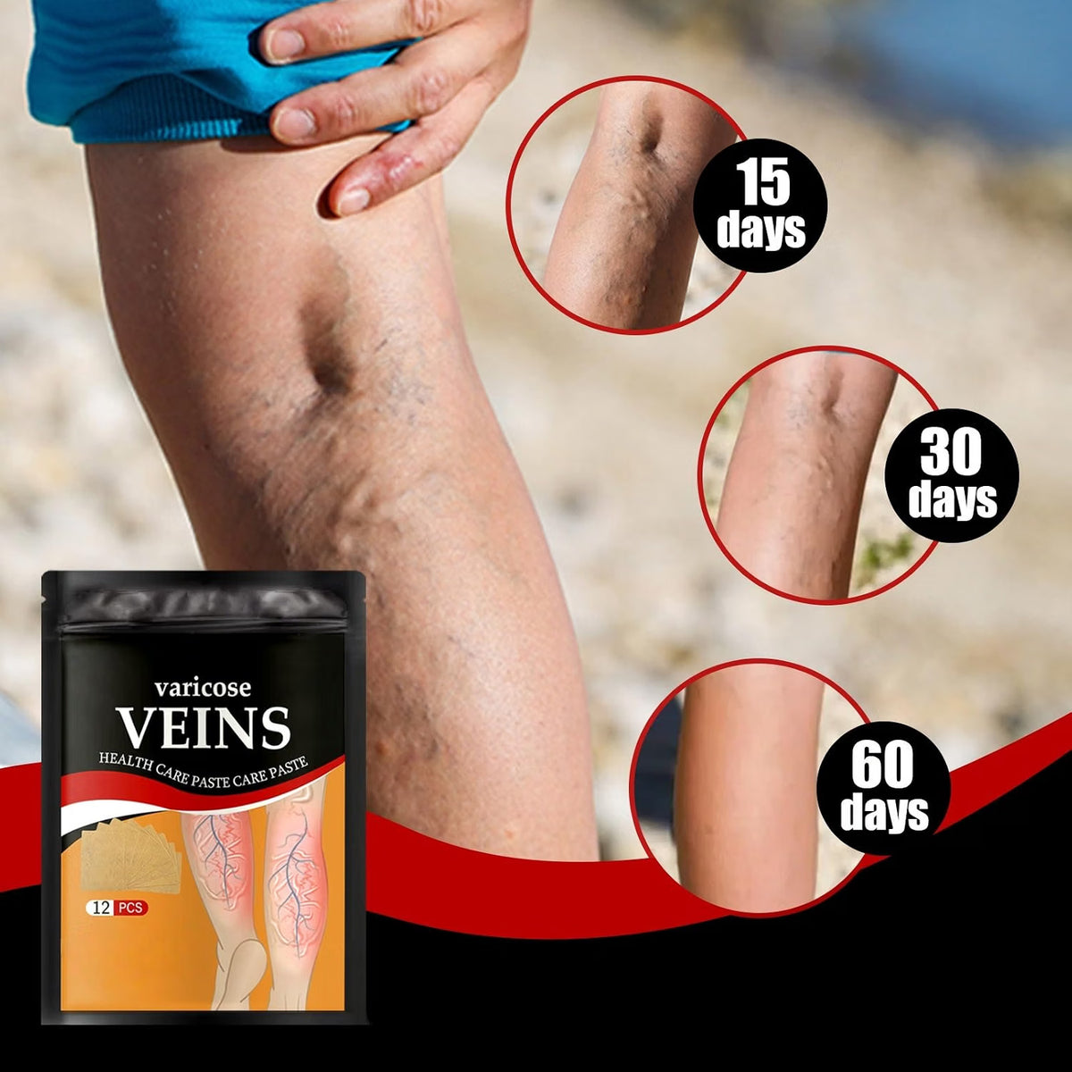 Adhesive Leg Care Patches – 2 Boxes