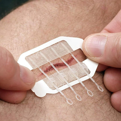 3-Pack Wound Closure Device (PU 2 Straps)