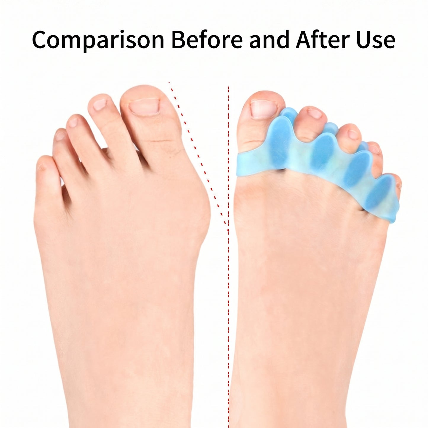 Pro Toe Separators 3 Pack – Foot Spacer for Daily Wear