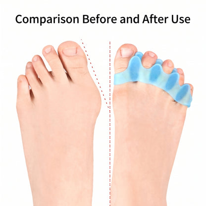 Pro Toe Separators 3 Pack – Foot Spacer for Daily Wear