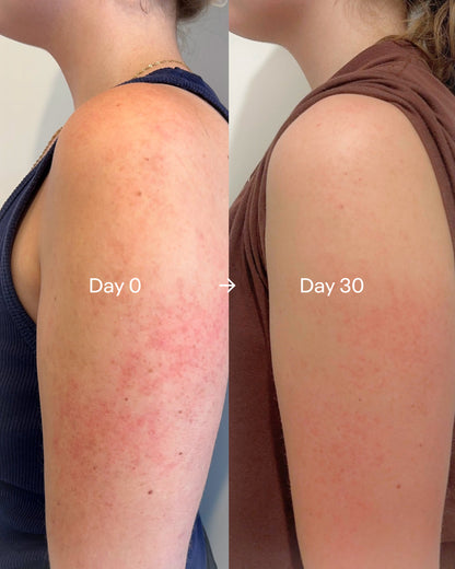 High-Pressure Handheld Shower Head with 3 Spray Modes & Filter, Includes 59" Hose