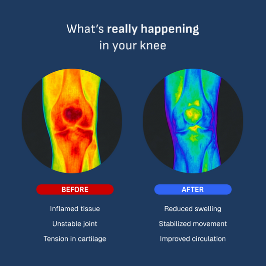 Smart Knob Knee Sleeve