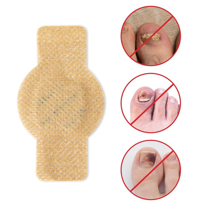 NailHeal™ - Fungal Nail Patches -63 Count (3 Packs of 21)